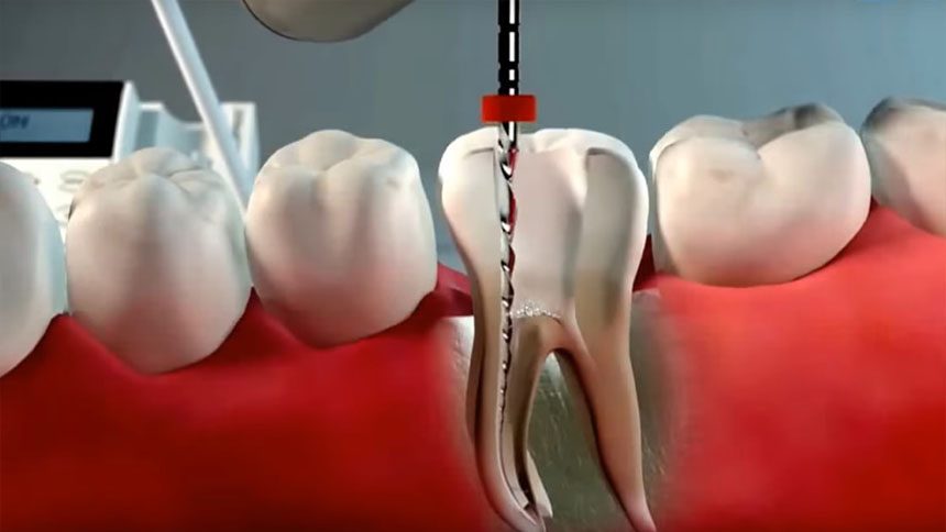 Endodontia